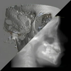 DICOM to Synthetic Ceph Conversion